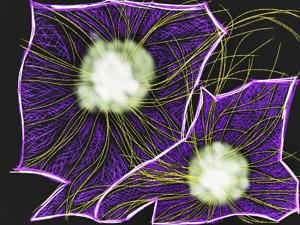Neurons By albastrica mititica/Flickr Creative Commons Illustration/photo of neurons