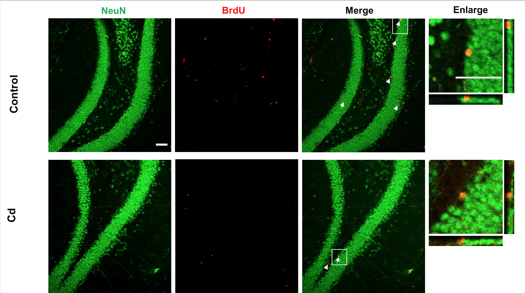 Images of slices of brain tissue with mature neurons fluorescing green and brand new cells fluorescing red. 