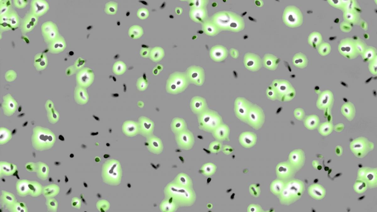 Drug-sensitive (halo) and drug-resistant (no halo) forms of the environmental pathogen Mycobacterium avium